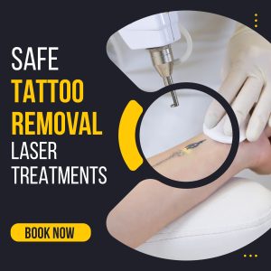 Carbon Facial Treatment